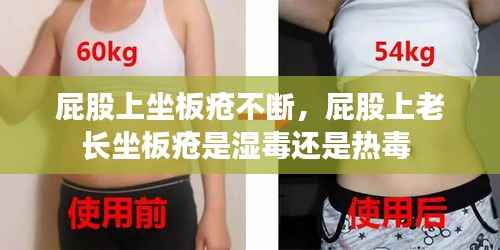 屁股上坐板疮不断,屁股上老长坐板疮是湿毒还是热毒