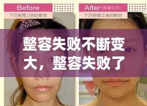 整容失败不断变大,整容失败了后悔的要死