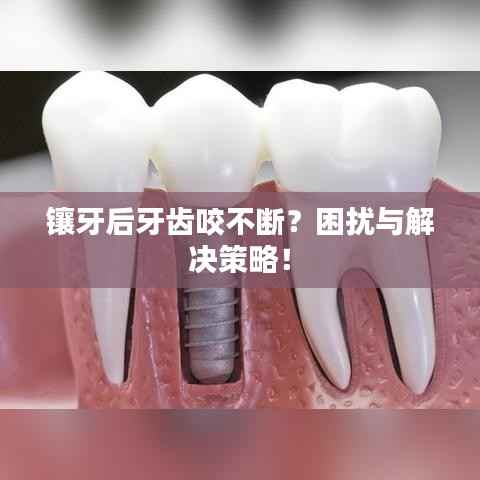 镶牙后牙齿咬不断?困扰与解决策略!