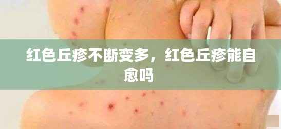 红色丘疹不断变多,红色丘疹能自愈吗
