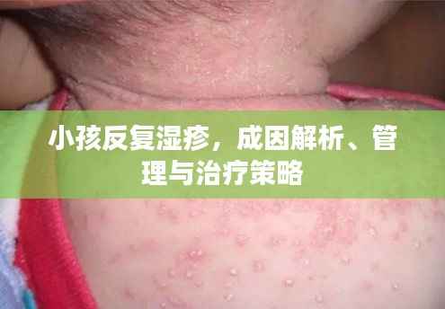小孩反复湿疹,成因解析、管理与治疗策略