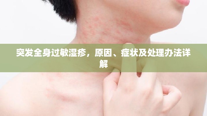 突发全身过敏湿疹,原因、症状及处理办法详解